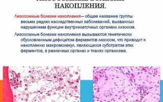 Немеют руки: причины, симптомы, диагностика, лечение