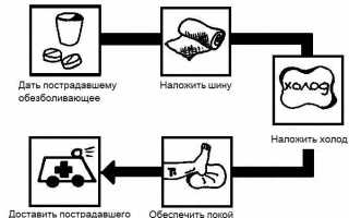 Реабилитация после перелома плечевого сустава