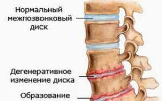 Тянет поясница вздутие живота