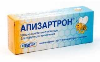 Названия самых лучших (эффективных) препаратов для уколов в суставы при болях и воспалениях